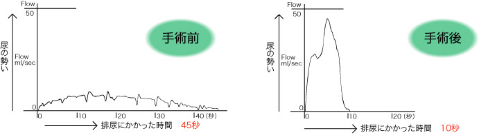 手術前と手術後